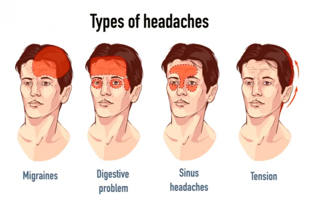 Headache vs. Migraine vs. Brain Tumor