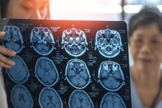 Head Injury or Stroke in Electronic City